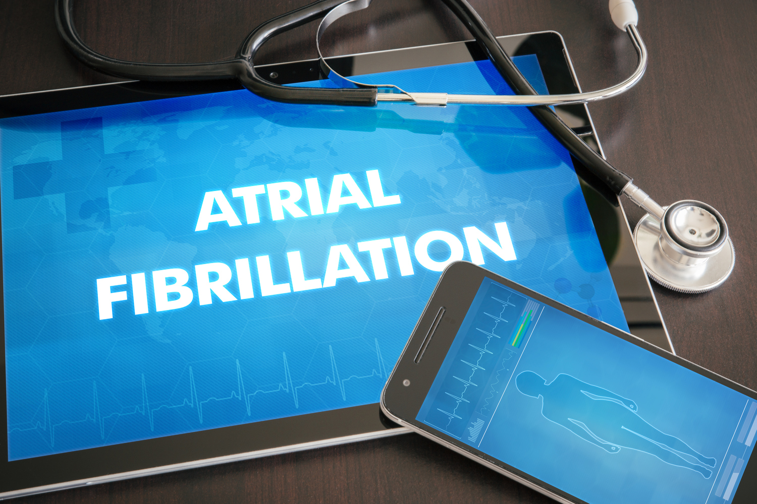 Cardioversion Treatment for Atrial Fibrillation