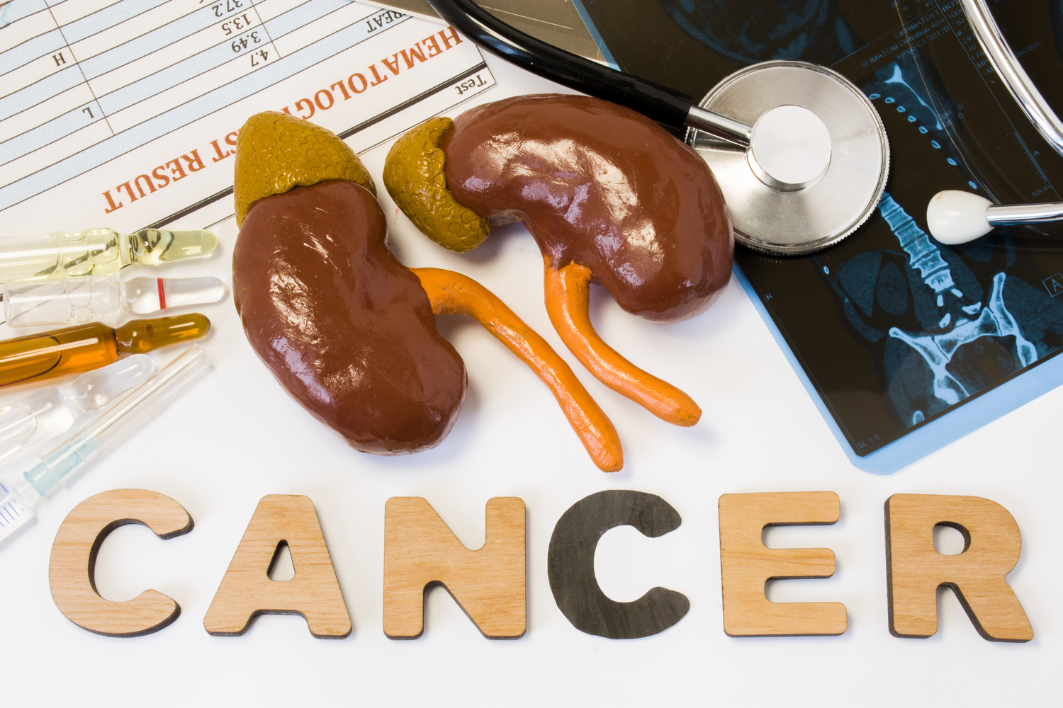 Side Effects of Treatment for Kidney Cancer
