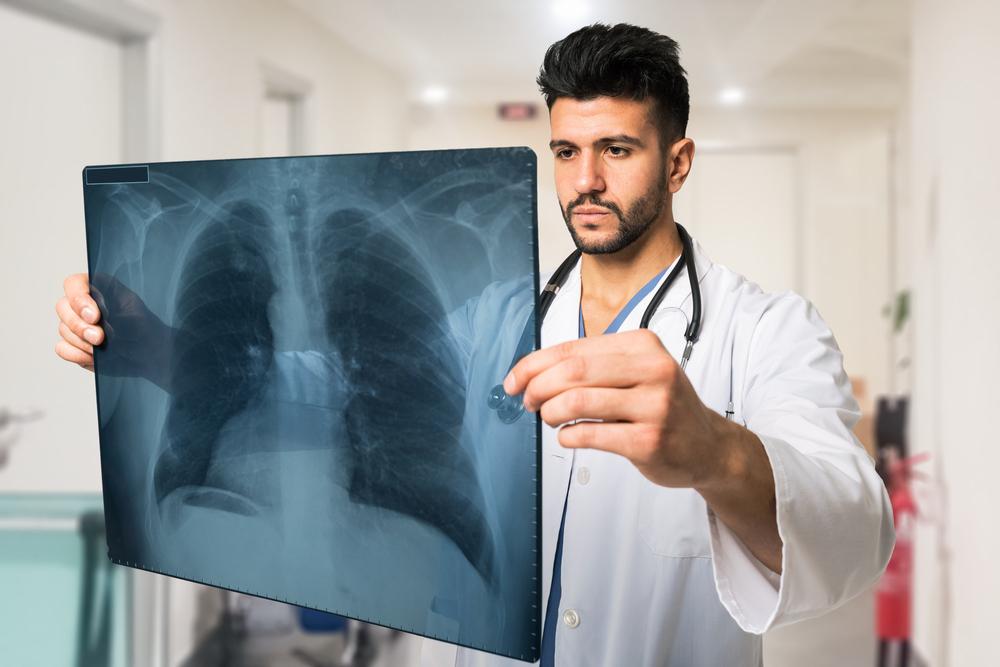 Radiation Therapy for Non-Small Cell Lung Cancer