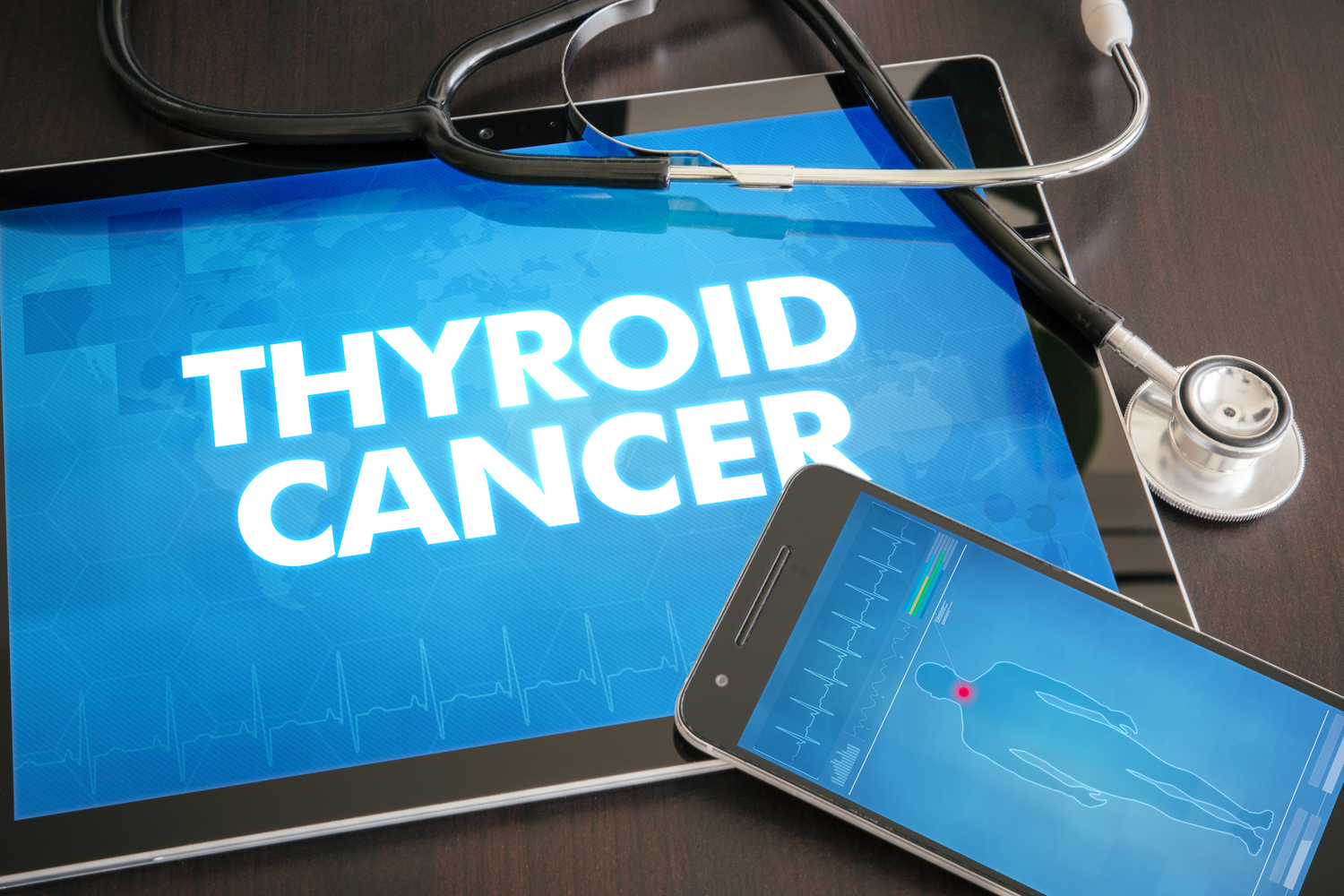 The Types of Thyroid Cancer