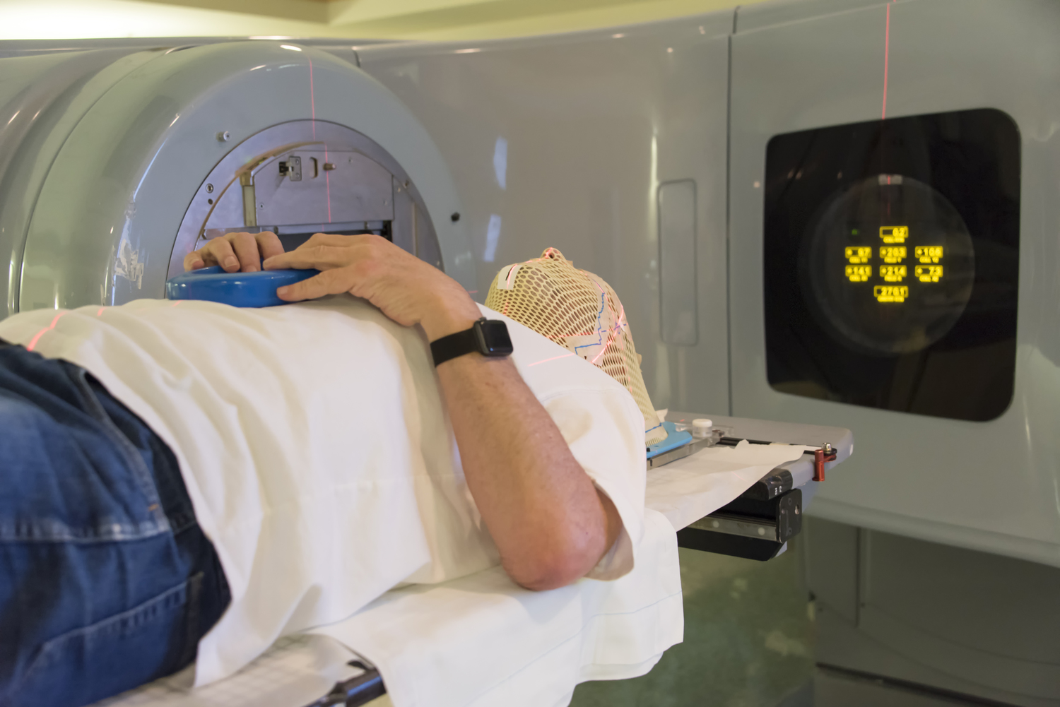 Treating Multiple Sclerosis Using Cell Therapy